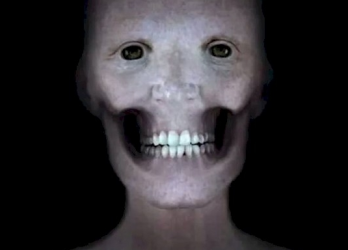 Khuôn mặt con người như thế nào khi không có lớp cơ bao phủ?